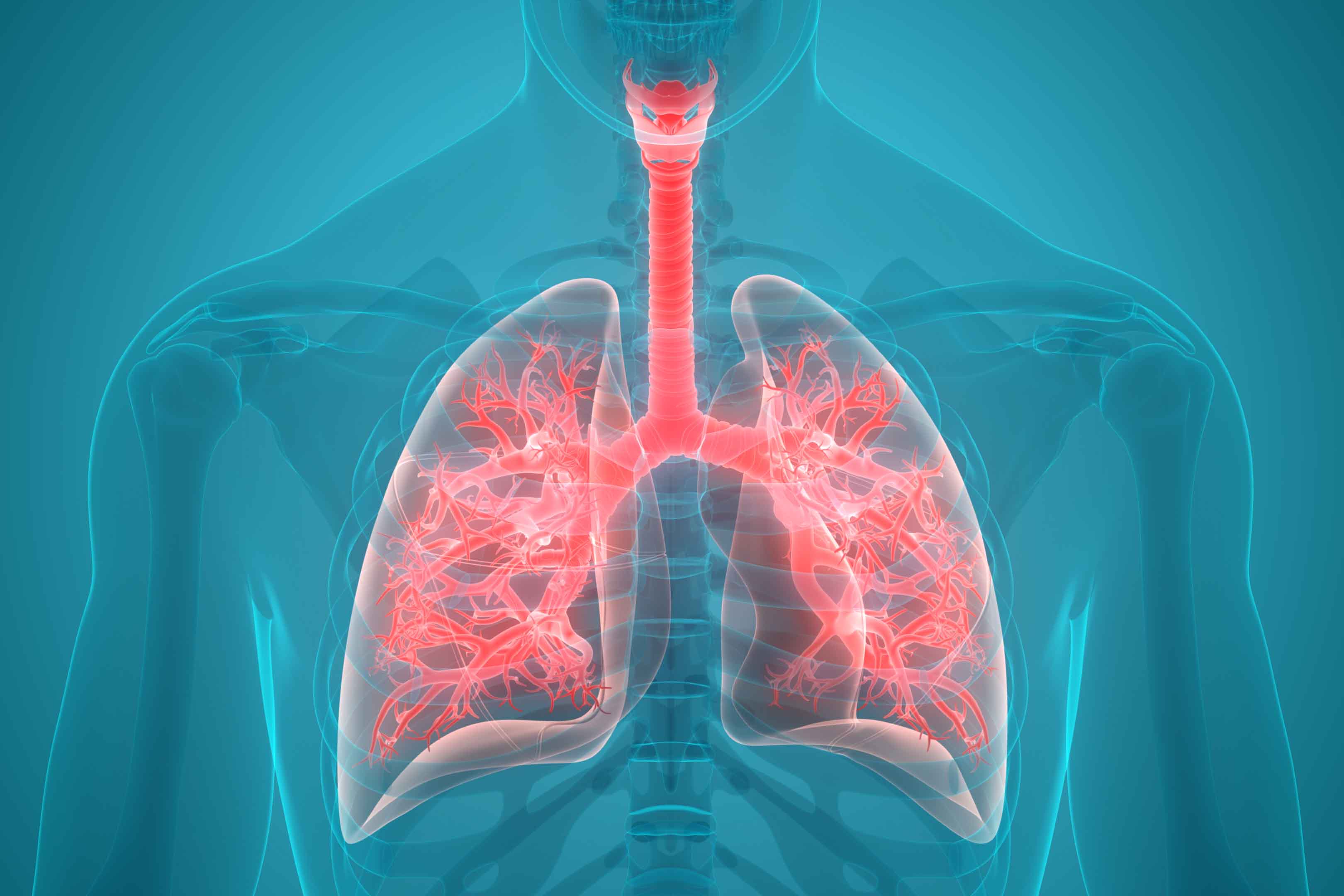 What Causes Lung Pain In The Back Roswell Park Comprehensive Cancer Center