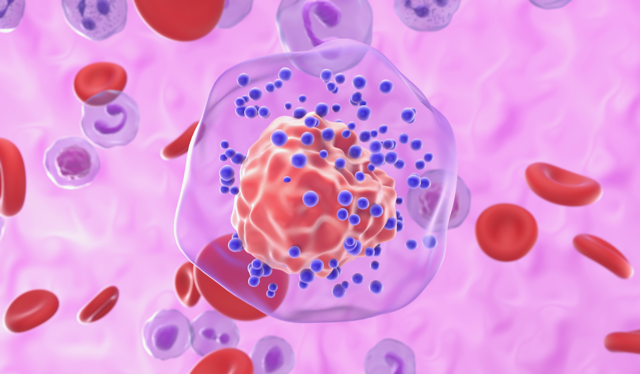 Roswell Park Leads Largest-Ever Genomic Study of Triple-Negative