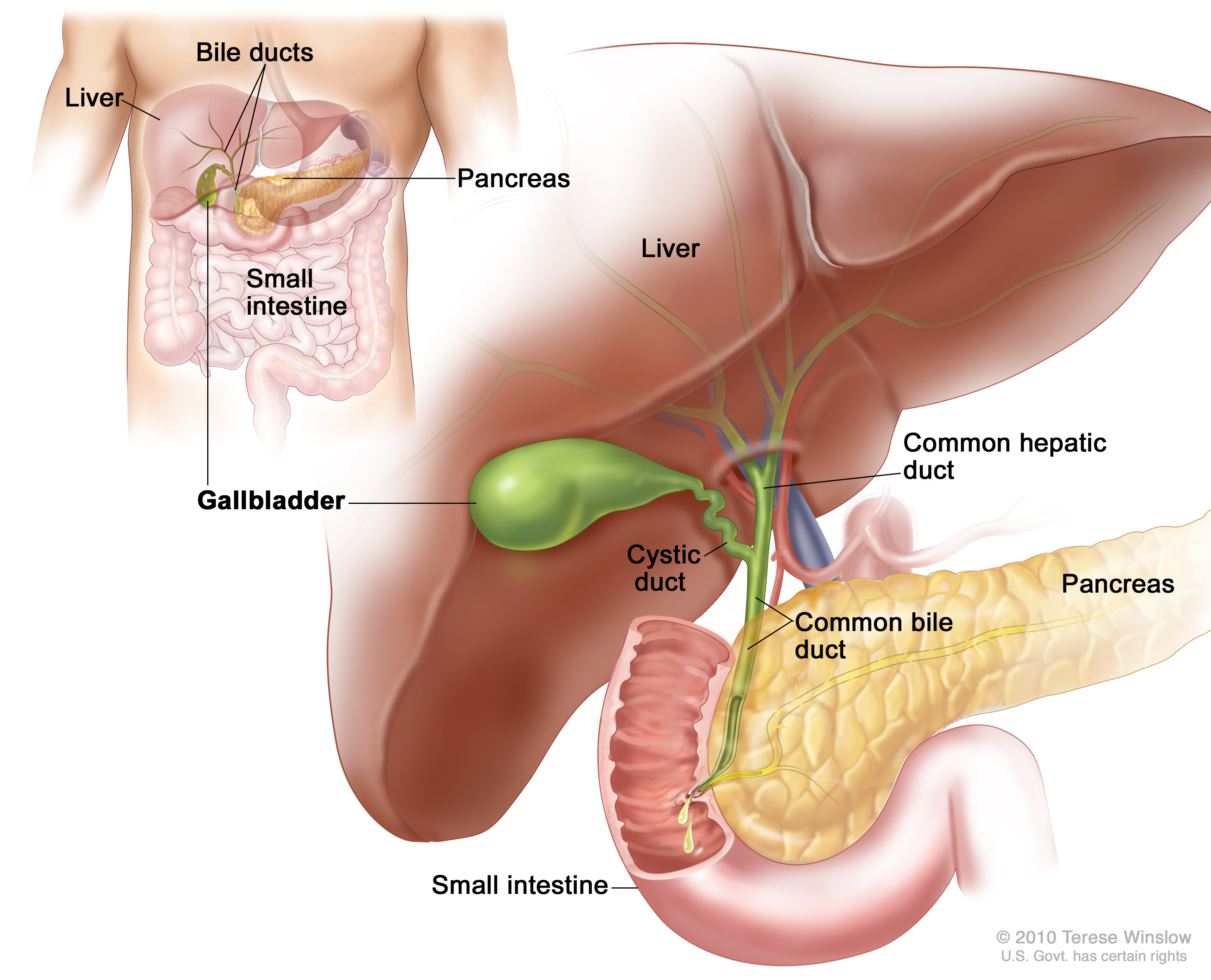 liver cancer 