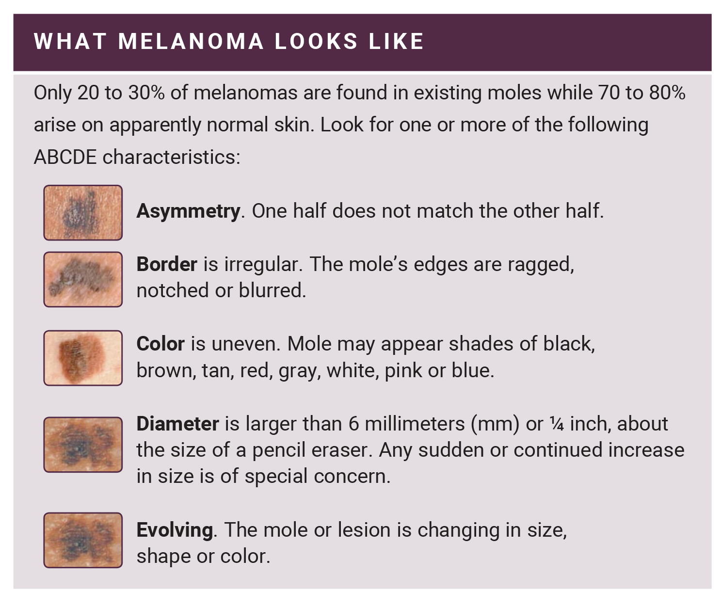 Mole Chart For Skin Cancer