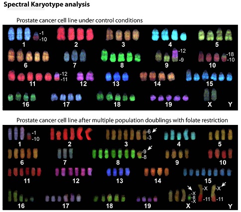 Spectral karyotype analysis indicates that folate deficiency over multiple population doublings induces changes to ploidy and accumulation of translocations in a prostate cancer cell line. Adapted from Bistulfi et al, 2010 BMC Biology 8:6.