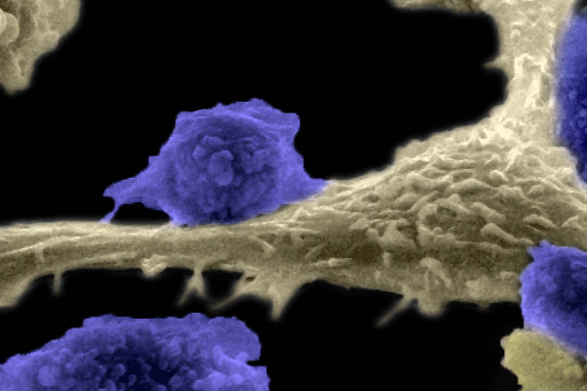 T cells attacking a cancer cell