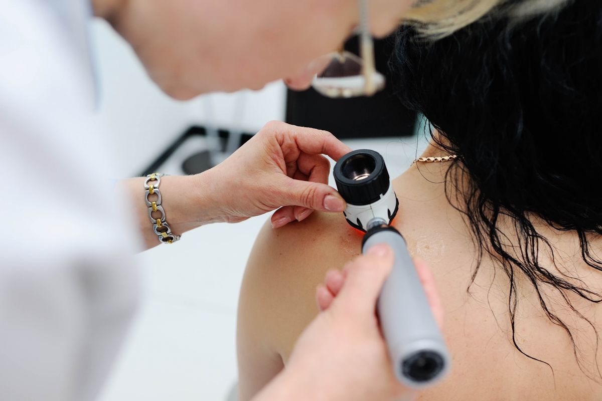 Doctor checking a woman's skin for skin cancer