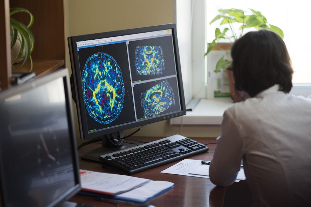 Person looking at a computer screen displaying brain CT scans