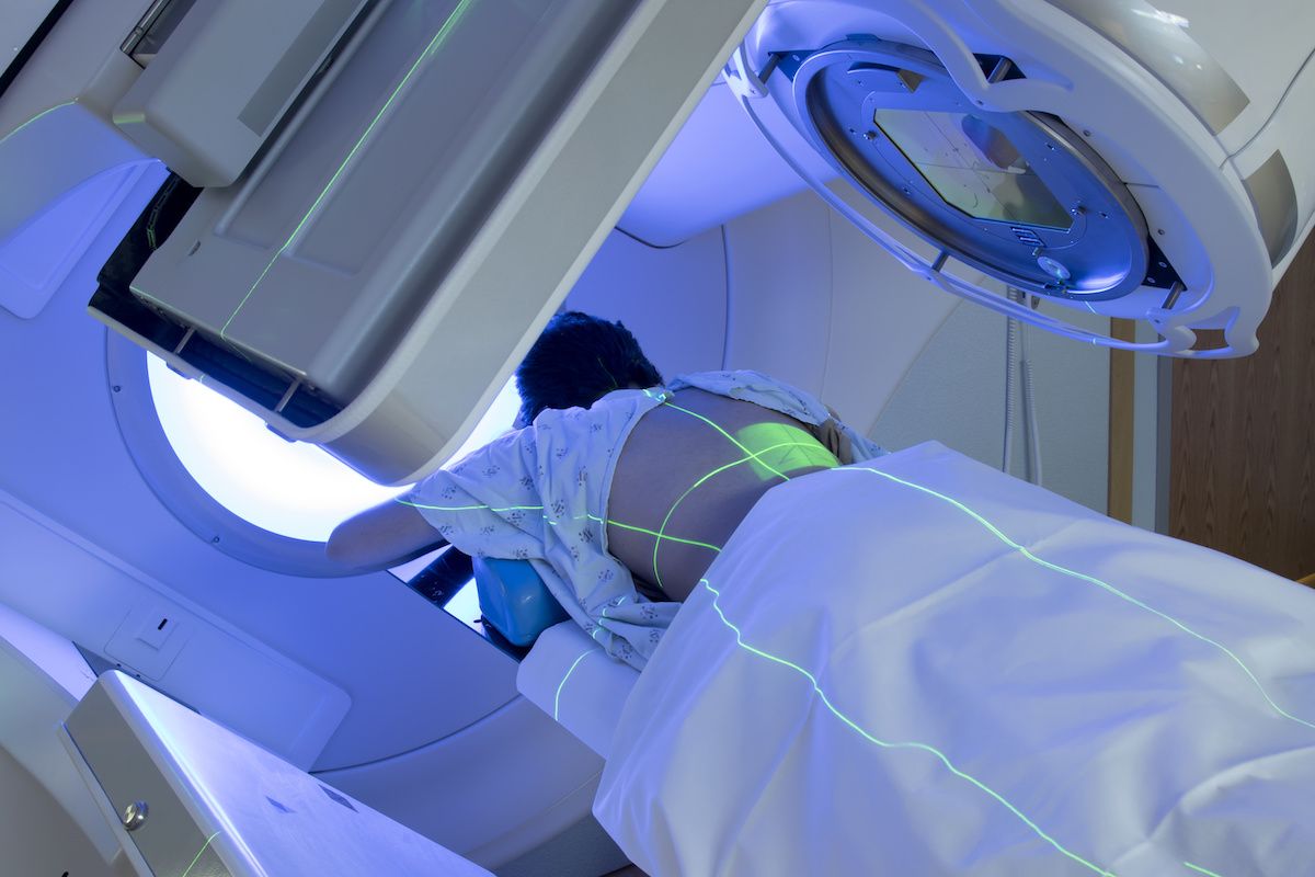Patient receiving radiation therapy for lung cancer