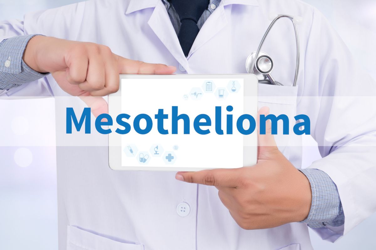 Mesothelioma stock image 