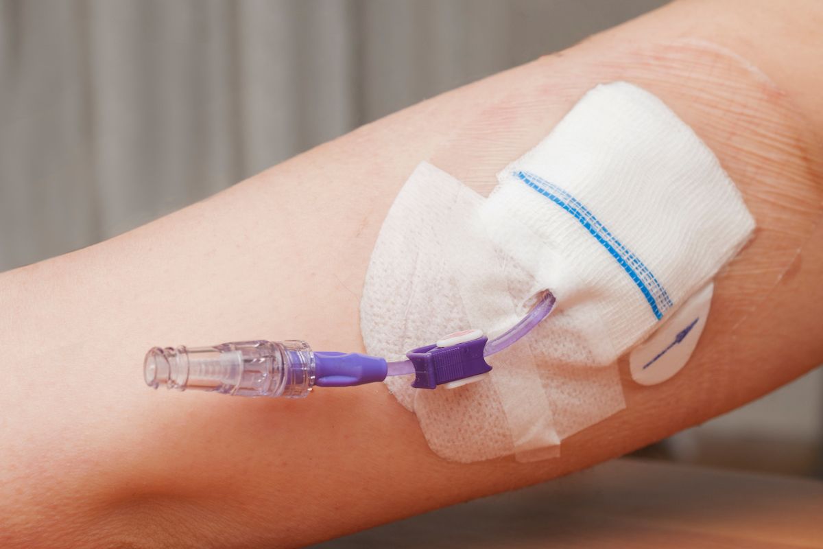 A intravenous PICC line is placed in a person's arm