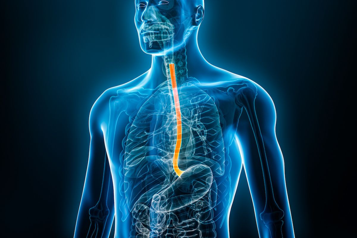 X-ray image of a person's upper GI tract with the esophagus highlighted in red