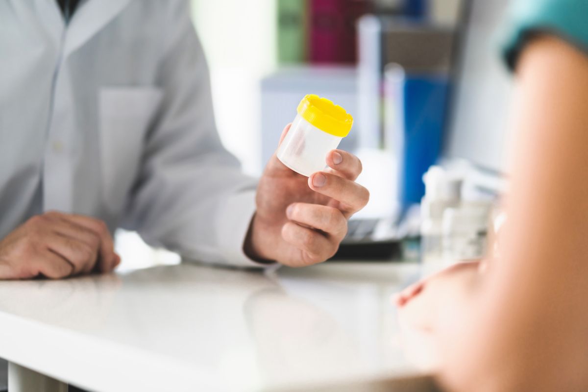 Person holding an empty urine sample cup 