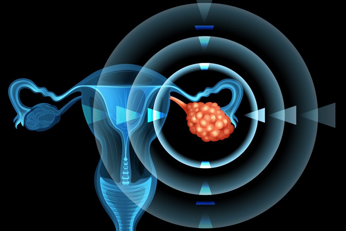 Female reproductive system with focus on the ovary