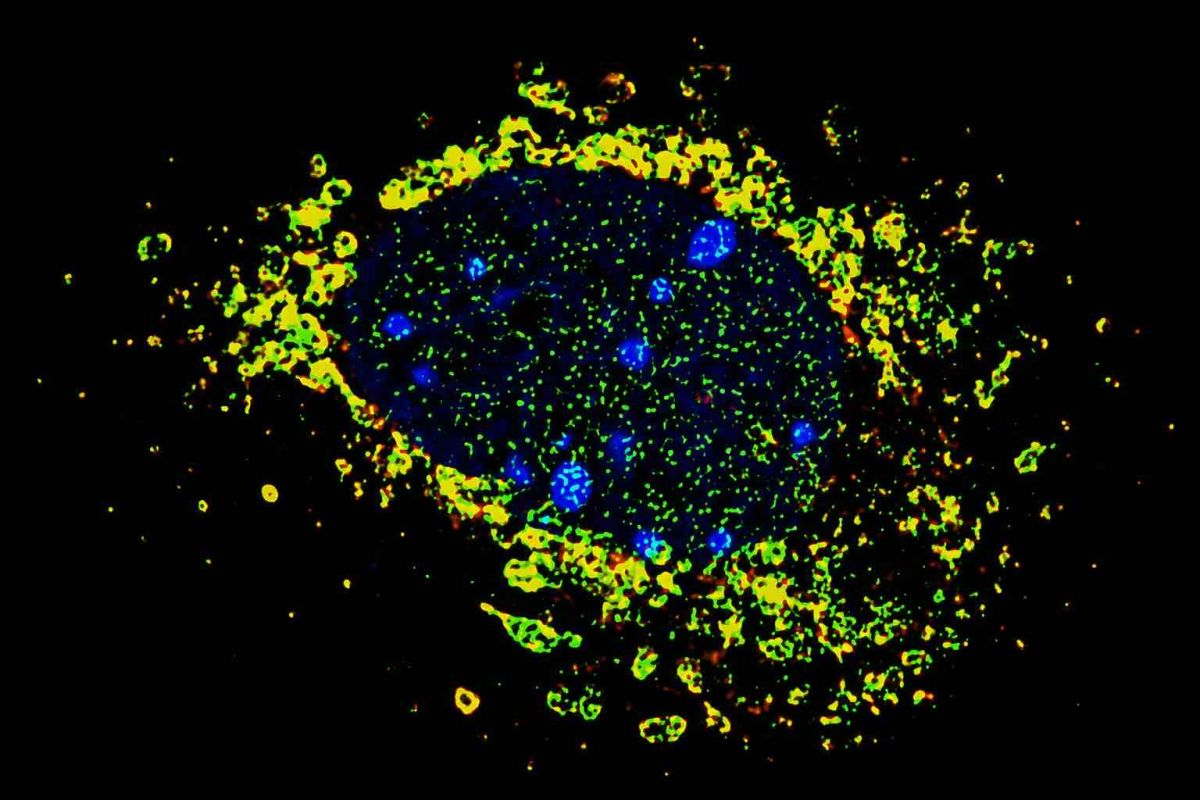 photo of cells