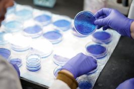 Scientists examining petri dishes