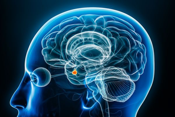 pituitary tumor