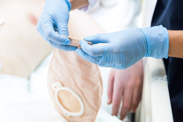 A doctor prepares an Ostomy for a patient