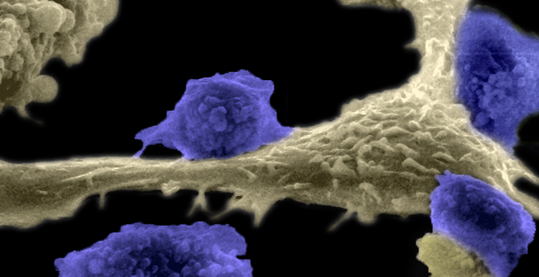 T cells attacking a cancer cell