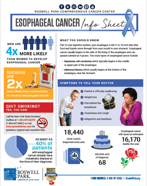 Esophageal cancer tip sheet