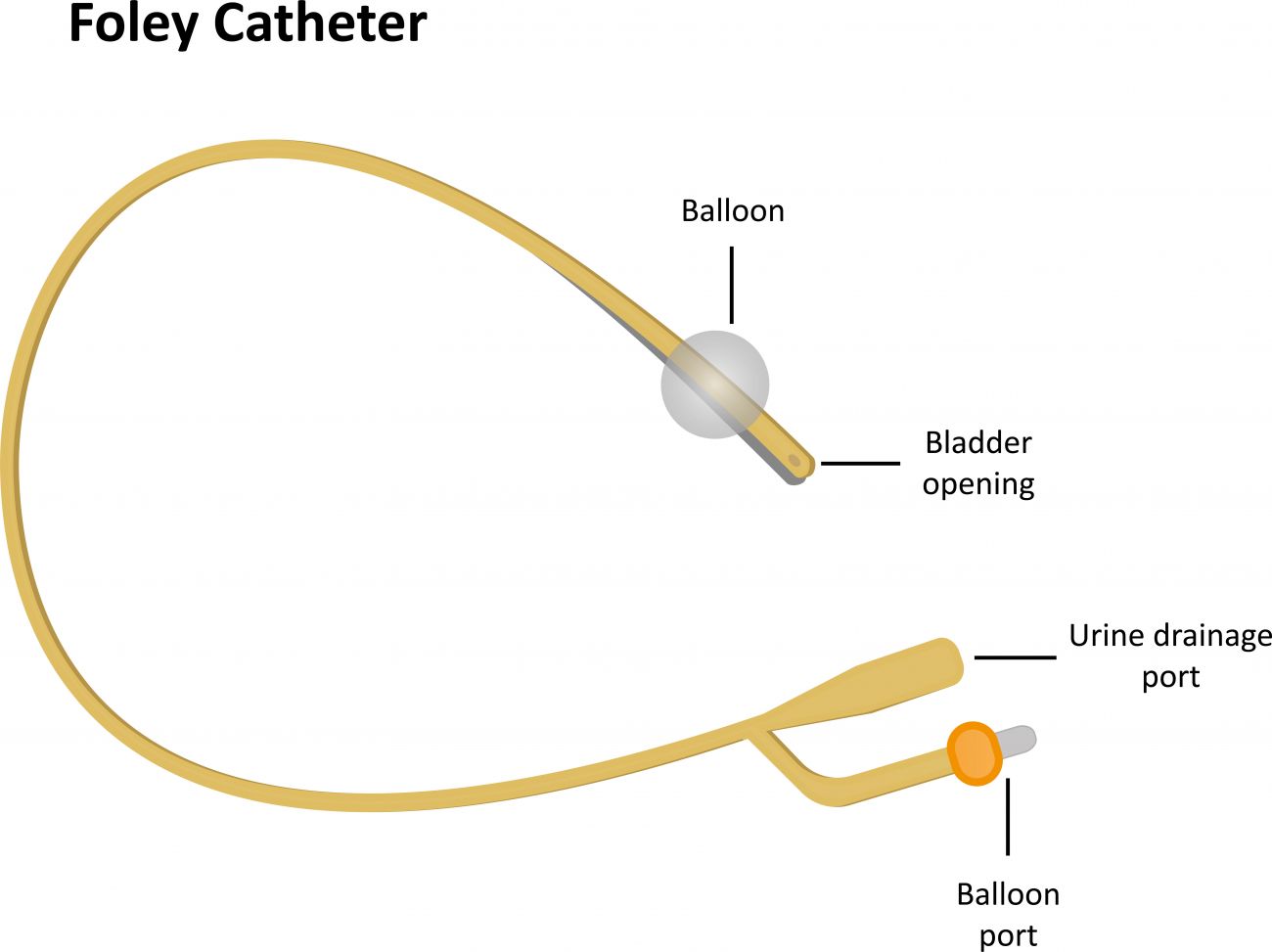Illustration shows the parts of a Foley catheter