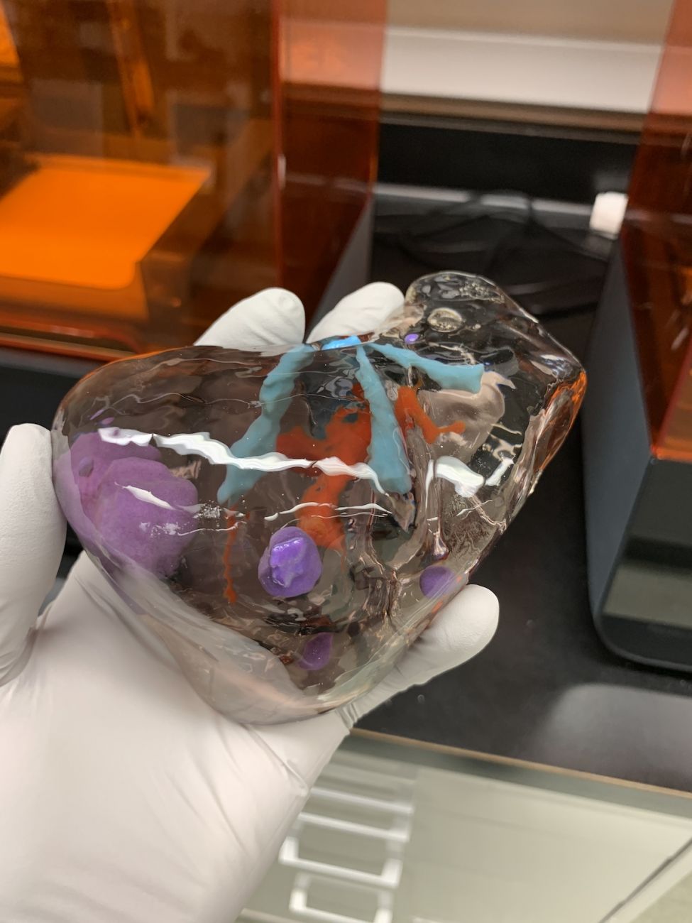 A clear 3D model of a liver, reduced in size, shows tumors and blood vessels inside the organ.