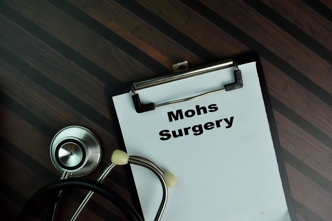 A clipboard with a piece of paper reading Mohs surgery sits on a wooden table with a stethoscope. 