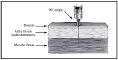 illustration of cross section of skin, 90 degree needle angle
