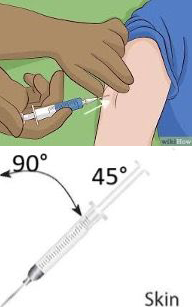 Subcutaneous Injection