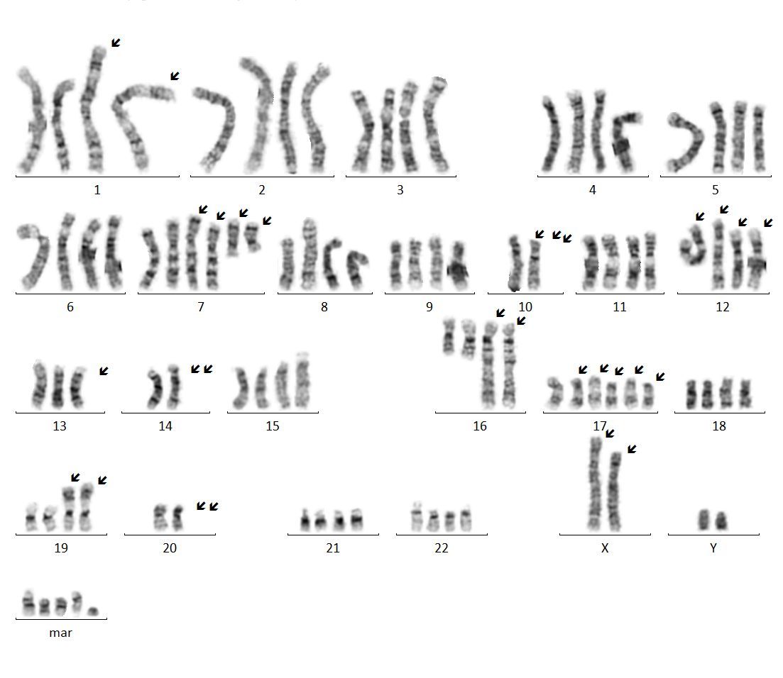 Cytogenetics Image for Hematopathology fellowship page 