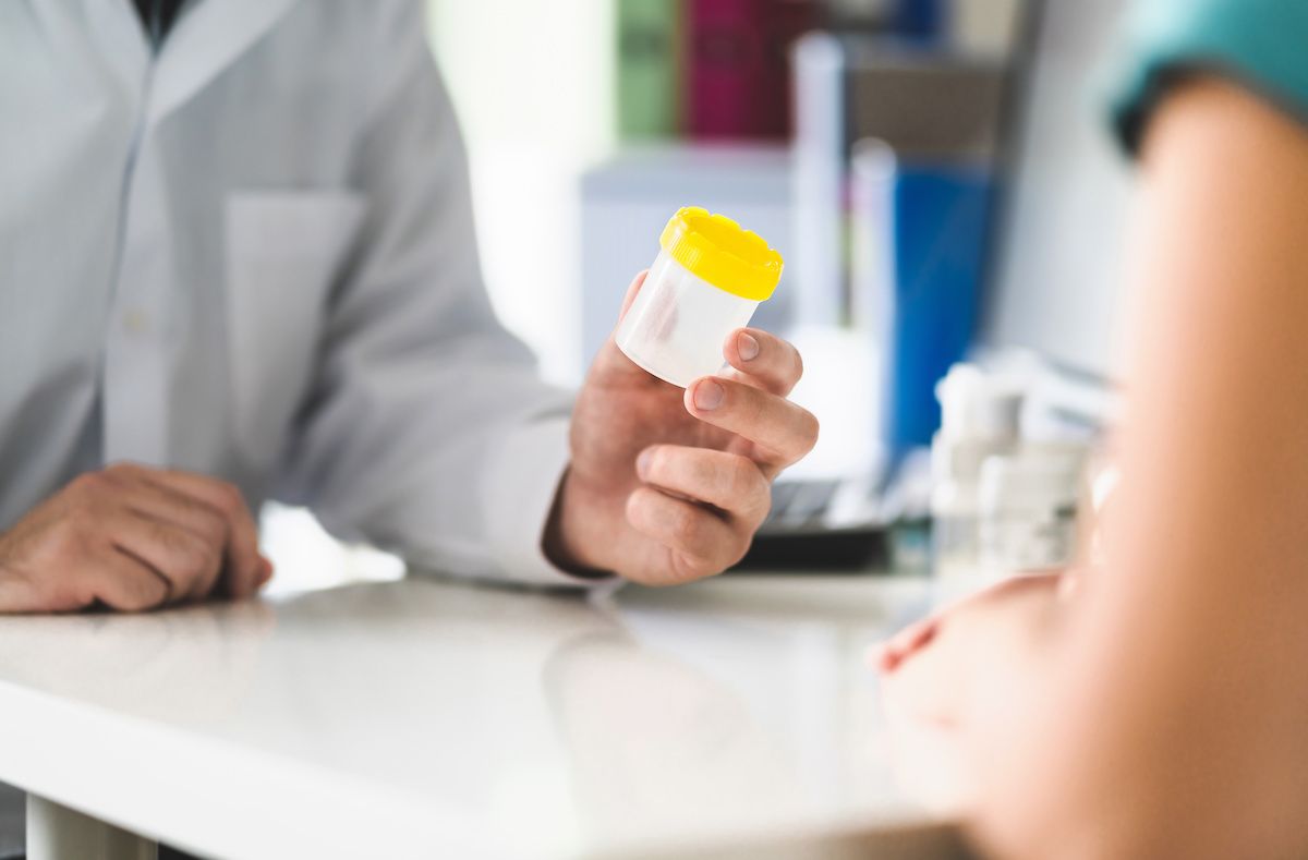 Person holding an empty urine sample cup 