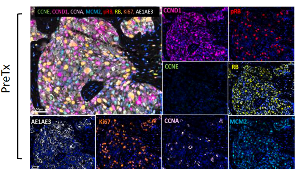 Cell slides from a microscope