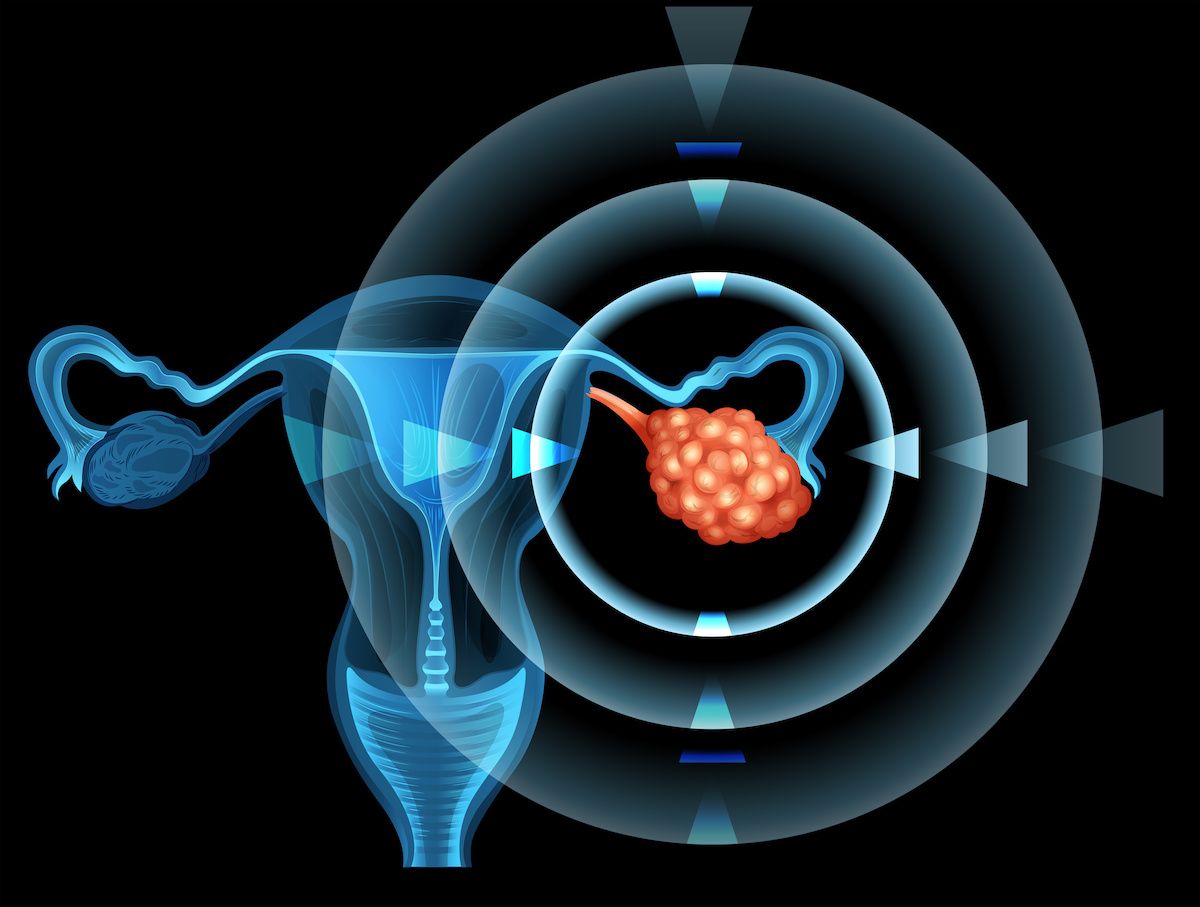 Female reproductive system with focus on the ovary