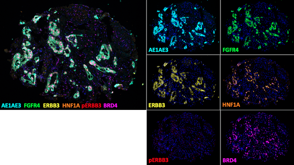 Cell slides from a microscope