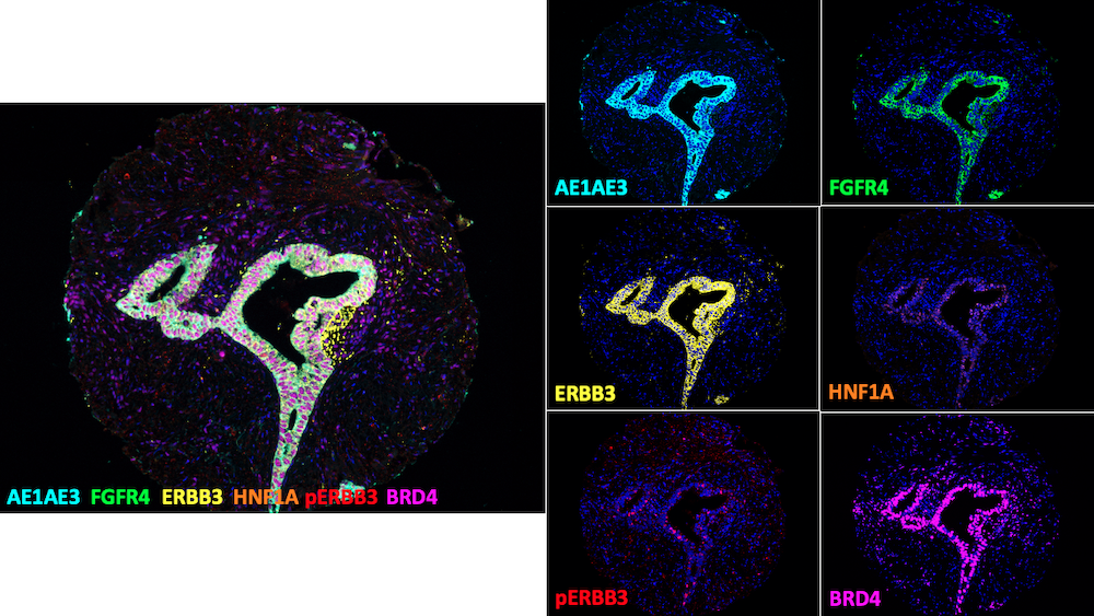 Cell slides from a microscope