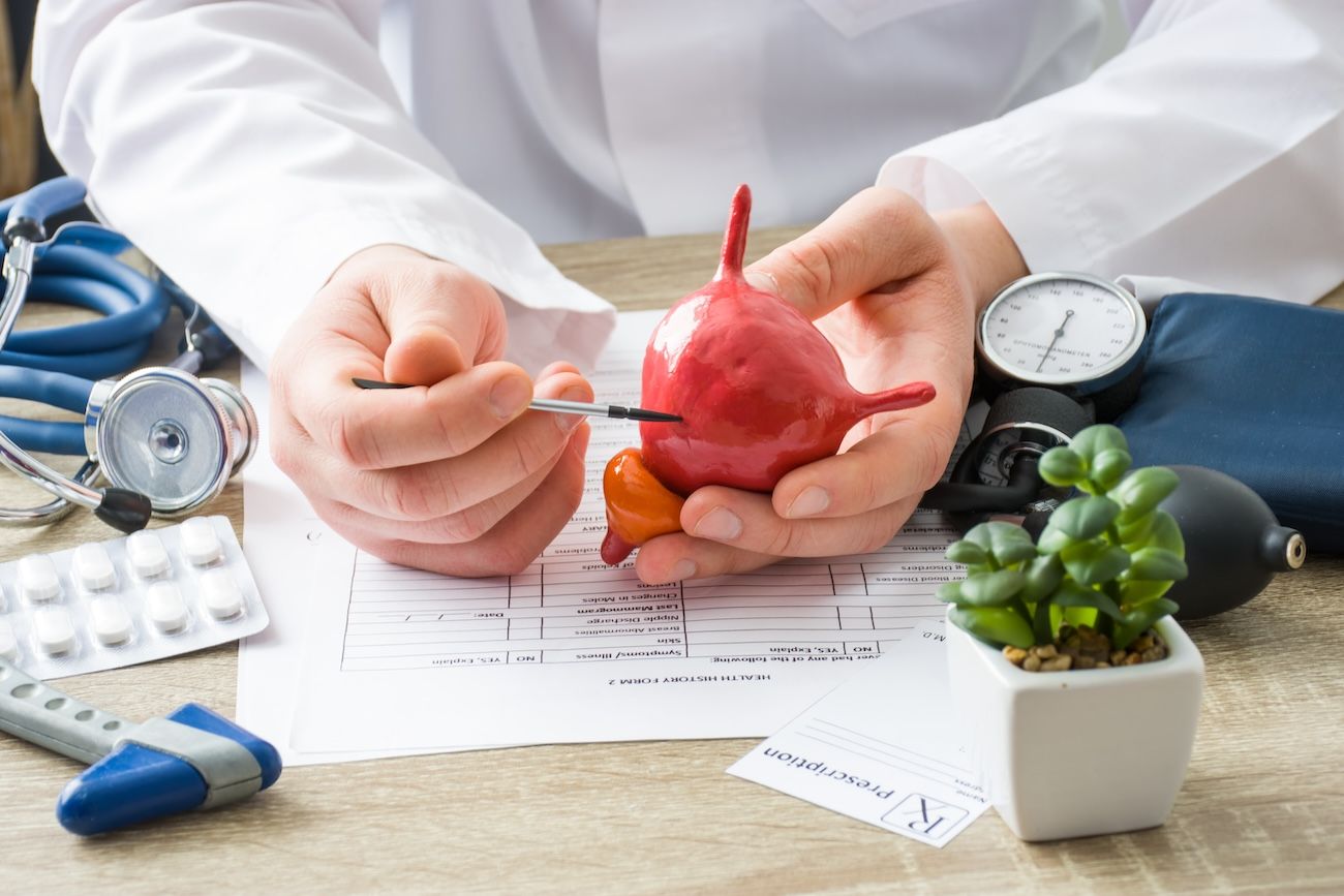 Doctor holding and pointing to 3D model of a bladder