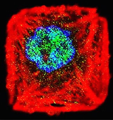 Cell slide from a microscope