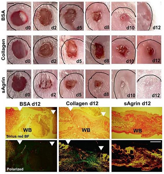Chakraborty Lab Research: Agrin and Wound Repair | Roswell Park
