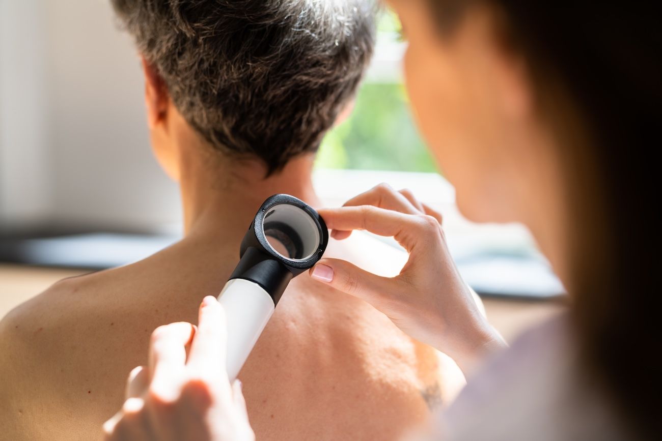 A dermatologist uses a magnify glass to examine a man's back