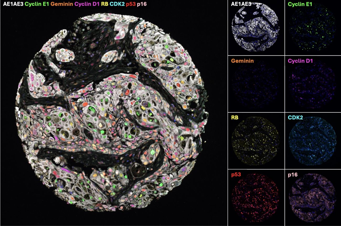 Multispectral Immunofluorescence (mIF) | Roswell Park