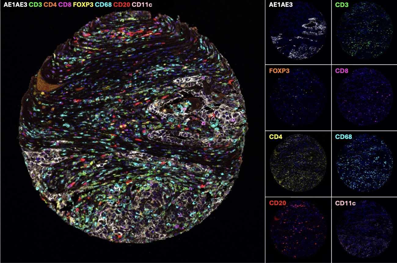 Multispectral Immunofluorescence (mIF) | Roswell Park