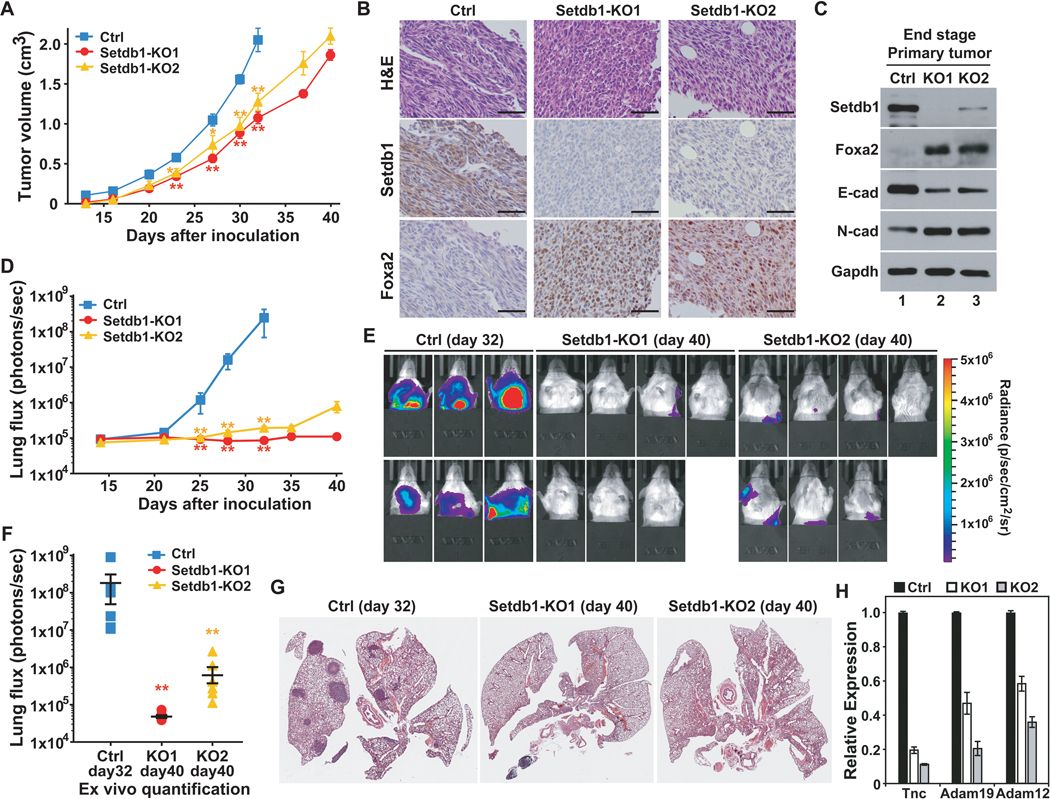 Fang Lab Research: SETDB1 in NSCLC Metastasis | Roswell Park