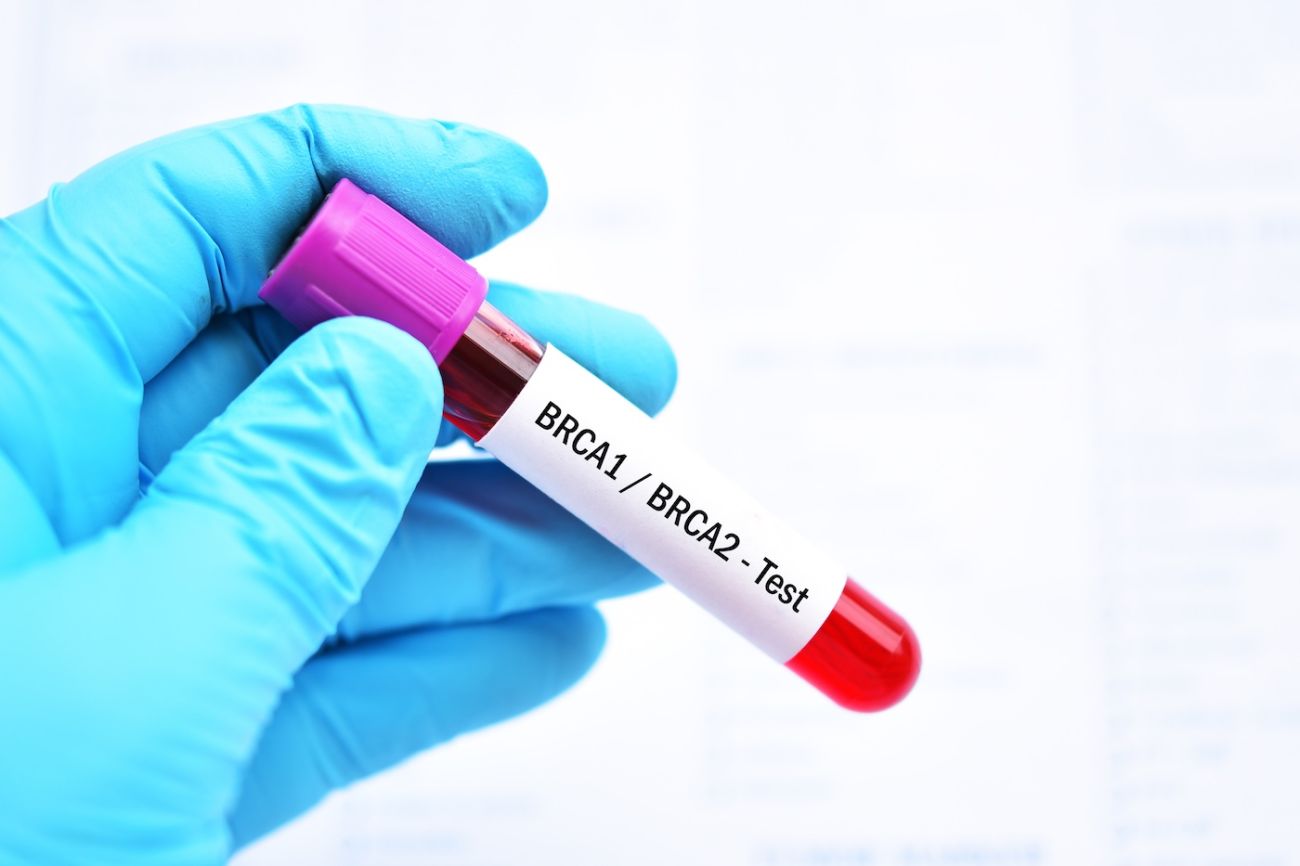 Gloved hand holding a test tube reading "BRCA Test" on the label 
