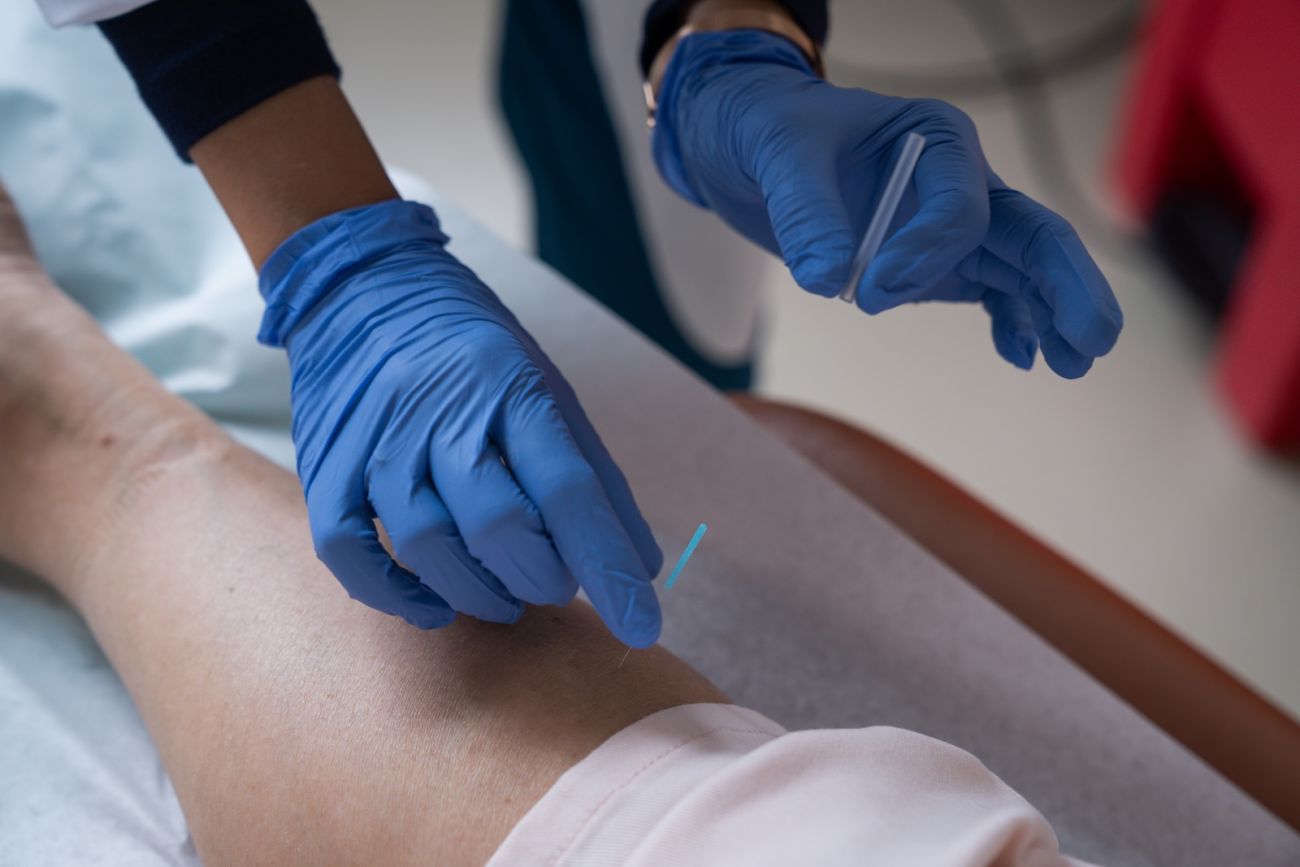 Dr. Sarwat Rumi inserts an acupuncture needle into a patient's arm