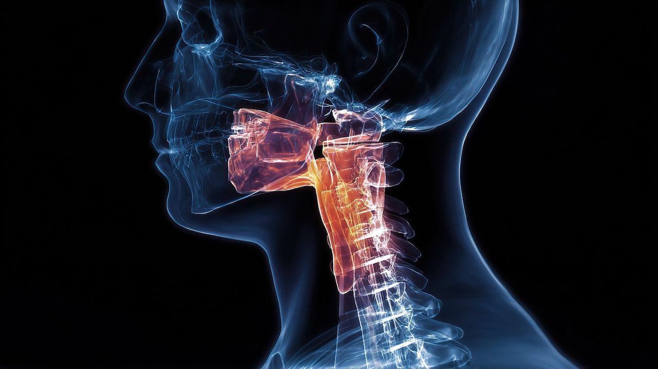 A medical illustration showing the outline of a human head and neck with the larynx highlighted in orange