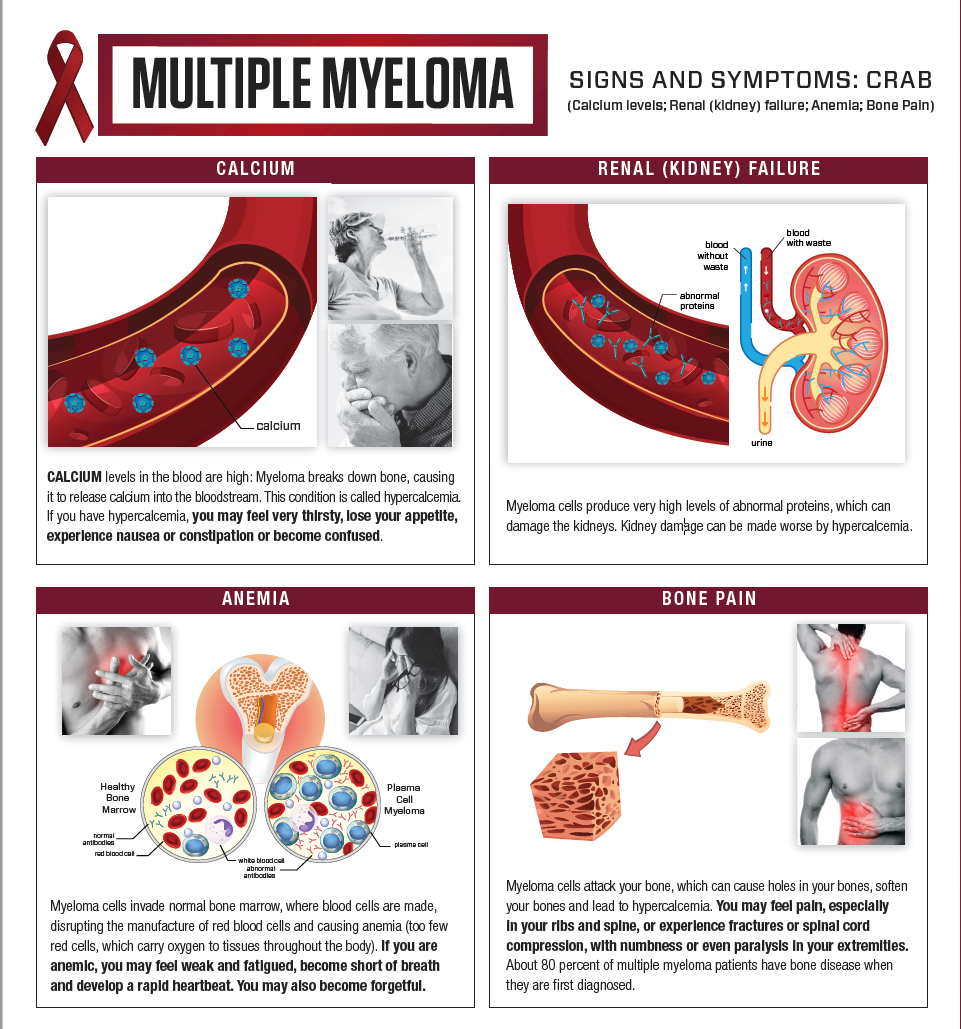 Multiple Myeloma Symptoms Roswell Park Comprehensive Cancer Center multiple-myeloma-symptoms-roswell-park-comprehensive-cancer-center