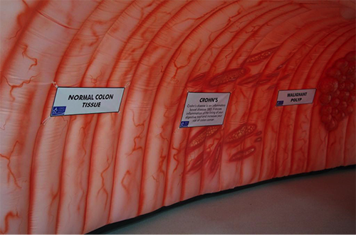 Giant Inflatable Colon exhibit