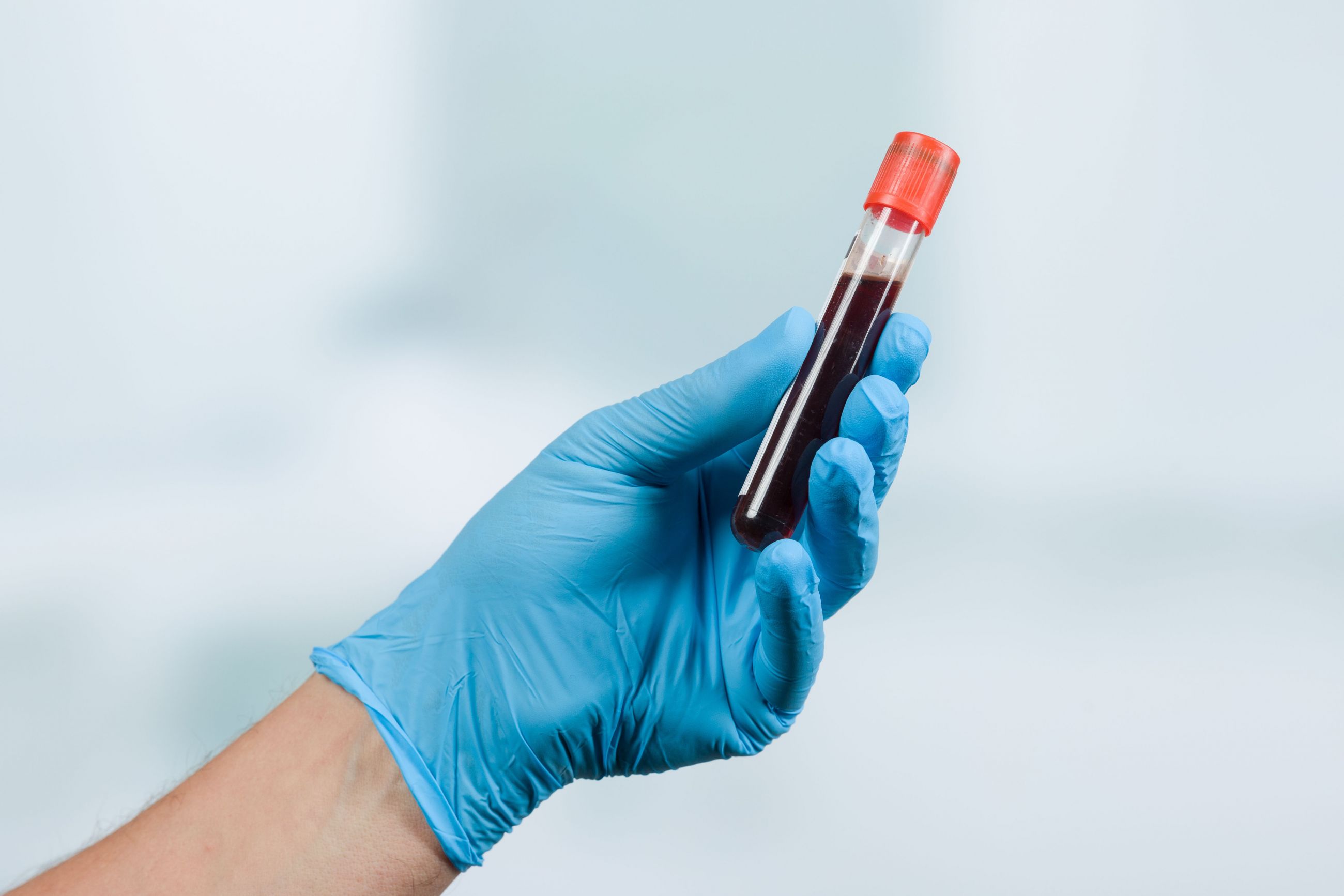 Frequently Asked Questions about the PSA Blood Test Roswell Park Comprehensive Cancer Center