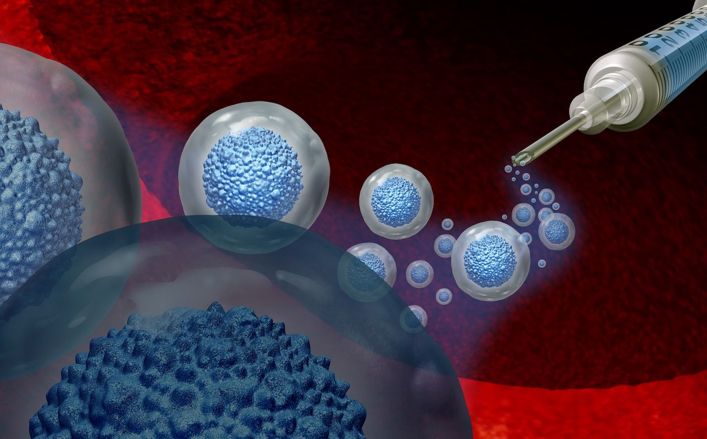 Cell Planting Method Planting the seeds of survival with stem cell transplant | Roswell Park ...