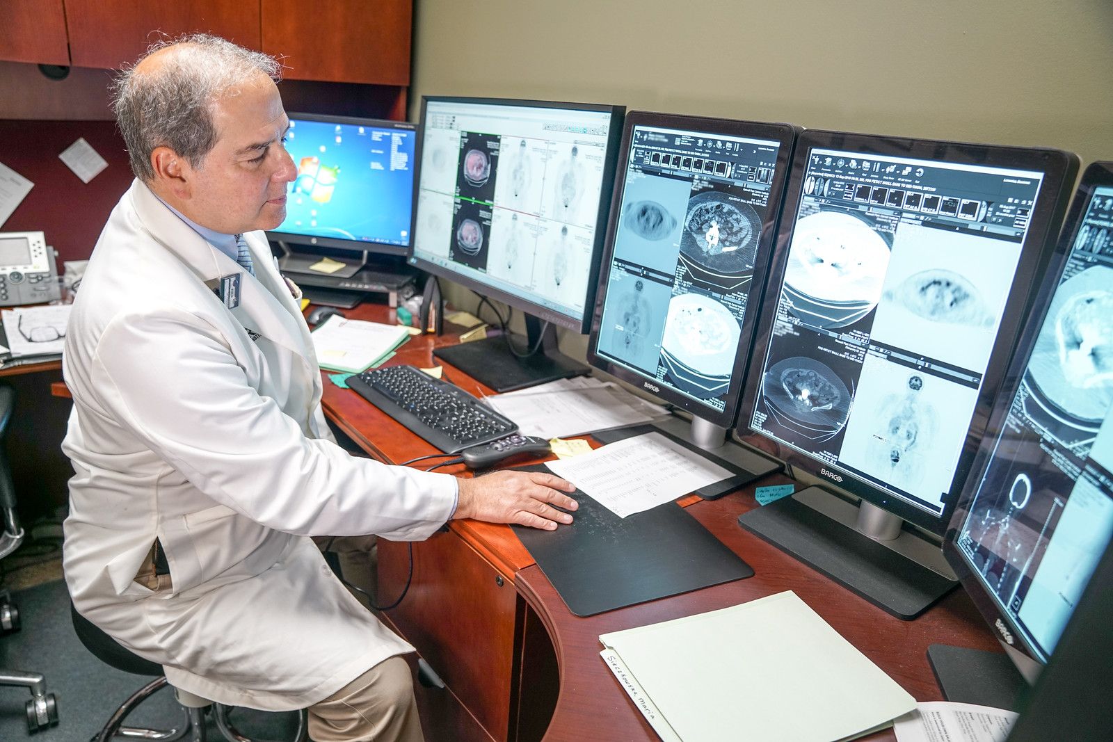 Multiple Myeloma Stages Roswell Park Comprehensive