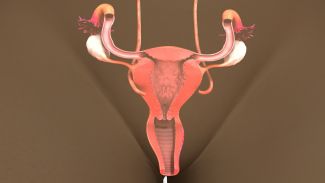 An illustrated view of the uterus, ovaries, and fallopian tubes