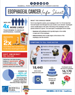 Esophageal cancer tip sheet