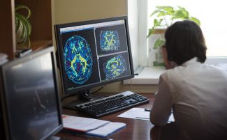 Person looking at a computer screen displaying brain CT scans