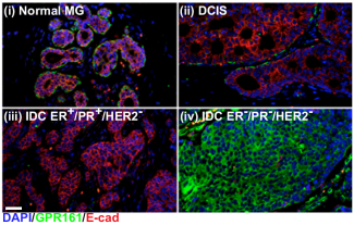 Expression of the orphan GPCR GPR161 in tissue